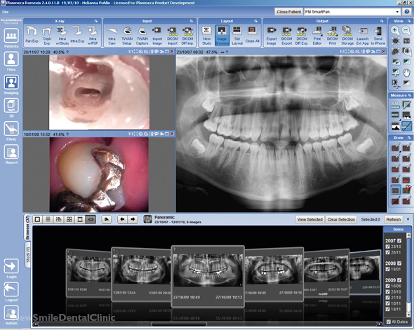 Computer programme of x-rays