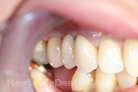 Case 6 - Bridgework