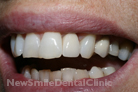 Case 2 - After Treatment