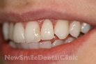 Case 3 - After Treatment