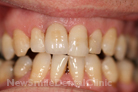 Case 5 - After Treatment