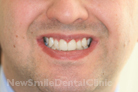 Case 7 - After Treatment