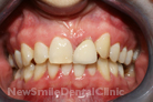 Case 13 - Before Treatment