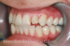Case 3 - Before Treatment