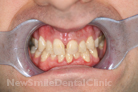 Case 7 - Before Treatment