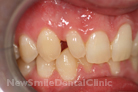 Case 8 - Before Treatment