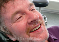 Dental Implants Case