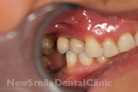 Case 1 - After Treatment