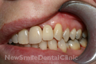 Case 2 - After Treatment