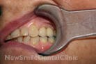 Case 3 - After Treatment