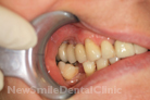 Case 4 - After Treatment