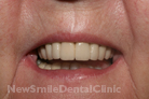 Case 2 - After Treatment