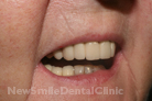 Case 2 - After Treatment