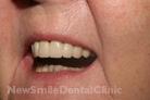 Case 2 - After Treatment