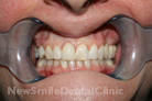 Case 3 - After Treatment