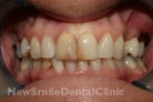 Case 3 - Before Treatment