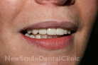 Case 6 - After Treatment