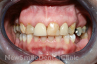Case 6 - Before Treatment