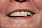 Case 5 - After Treatment