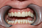 Case 5 - After Treatment