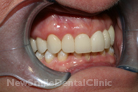 Case 5 - After Treatment