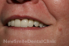 Case 5 - After Treatment