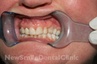Case 5 - Before Treatment