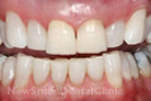 Case 1 - After Treatment