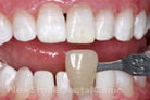 Case 2 - After Treatment