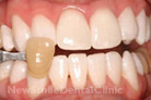 Case 3 - After Treatment