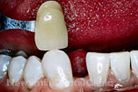 Case 5 - After Treatment