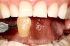 Case 6 - After Treatment