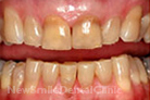 Case 1 - Before Treatment