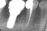 X Ray